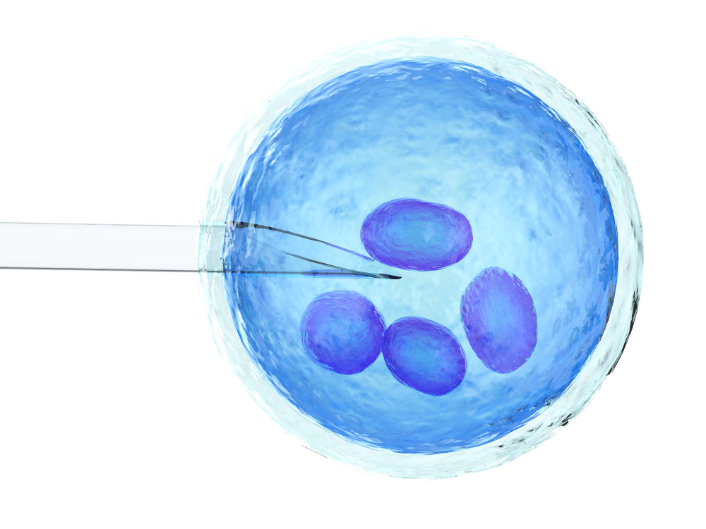 iVF1