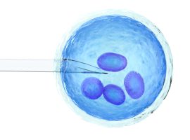 iVF1