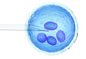 iVF1